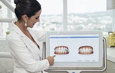 Escanemanto IntraOral