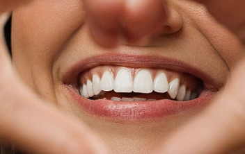 Odontologia Estética