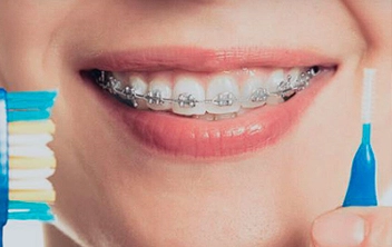 Ortodontia e ortopedia facial