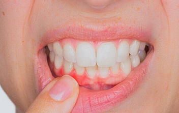 Periodontia